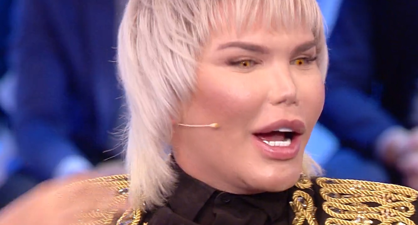 Ken humano | Rodrigo Alves | Brasil: está a punto de perder su nariz por  cirugías estéticas | VIDEO | Mundo | La República