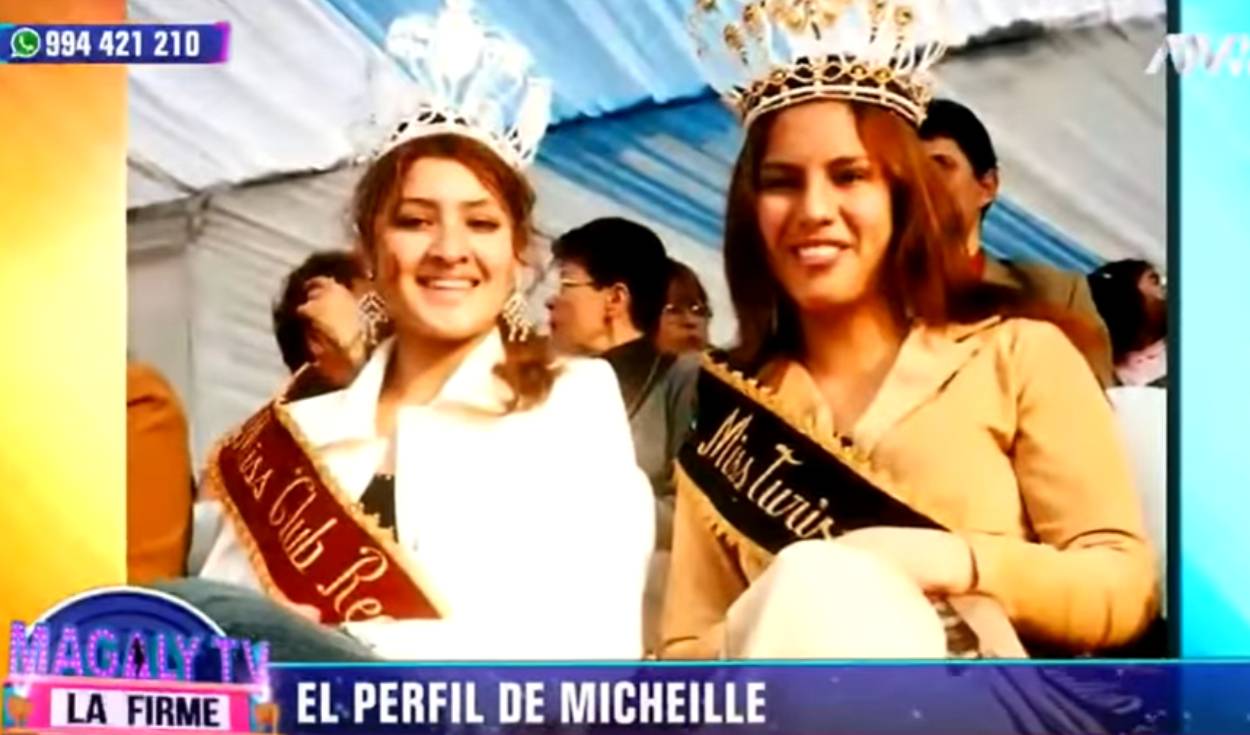 michelle soifer antes y despues