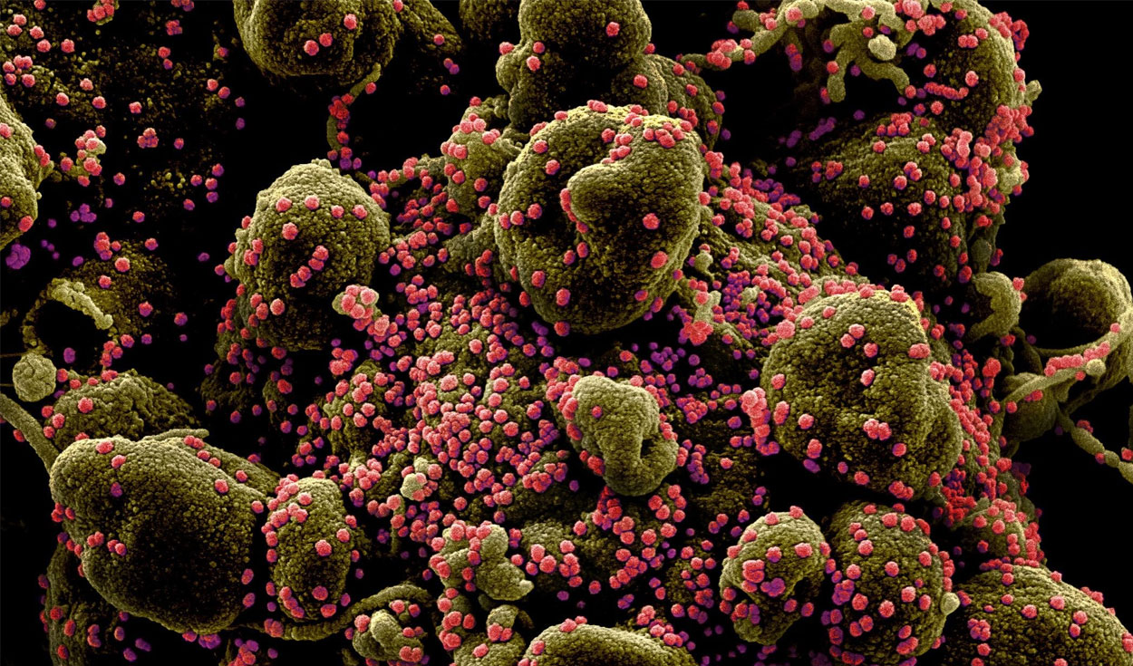 Partículas de SARS-CoV-2 saliendo de una célula infectada. Foto: NIAID