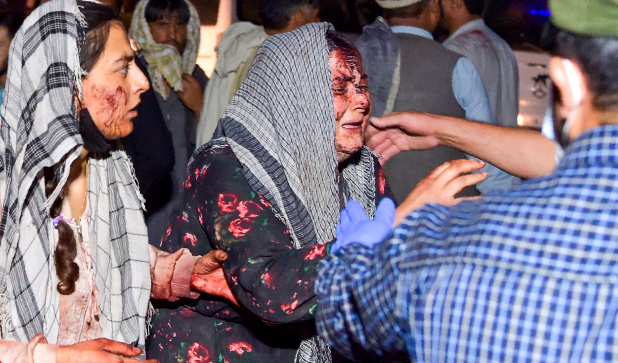 Las imágenes que ha dejado la doble explosión en la capital de Kabul, en Afganistán, dan muestra de la crueldad de lo ocurrido. Foto: AFP