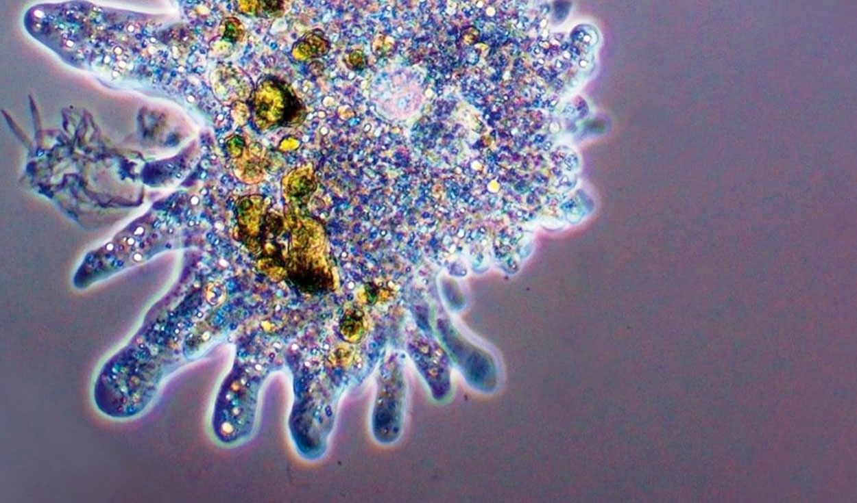 El virus detectado comenzó a infectar amebas en el laboratorio. Foto: referencial / Science Focus