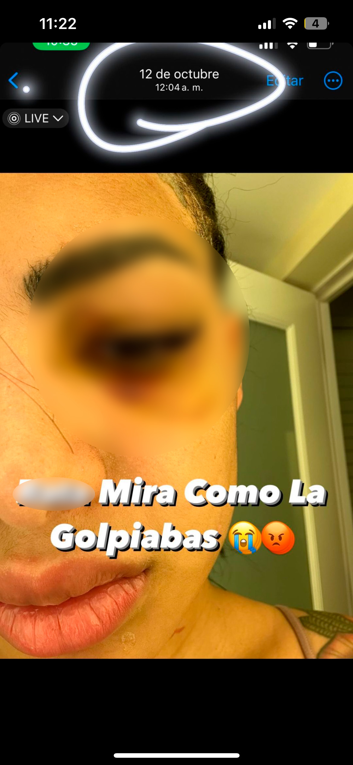 golpean a yailin | Yailin La Más Viral acusa a Tekashi 69 de agresión, pero  termina siendo ella la DETENIDA por la POLICÍA | yailin arrestada | yailin  la mas viral presa | que esta pasando con yailin | VIDEOS | arresto de  Yailin | tekashi le pega a yailin | Qué ...