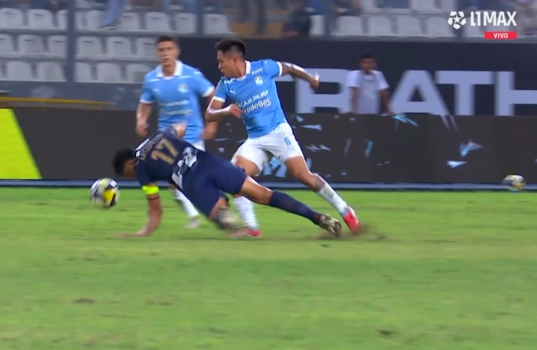 Jean Pierre Archimbaud sufrió terrible lesión en el brazo durante el Alianza Lima vs Cristal y se retiró llorando