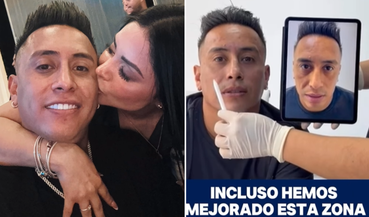 Christian Cueva sorprende al someterse a tratamiento de masculinización y muestra resultados en su rostro