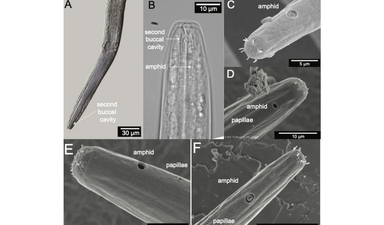 Imágenes microscópicas de Diplolaimelloides woaabi, la especie de nematodo recientemente identificada en el Gran Lago Salado. Foto: Journal of Nematology
