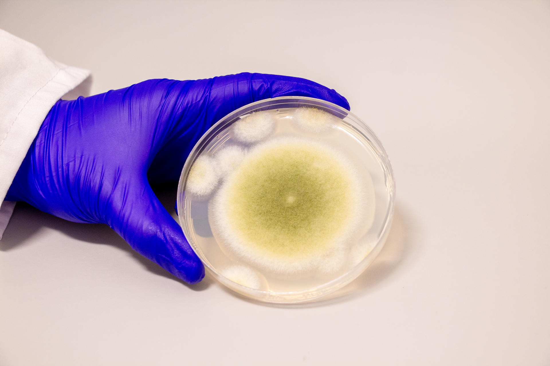 Una muestra de Aspergillus flavus cultivada en el Laboratorio Gao. Foto: Bella Ciervo