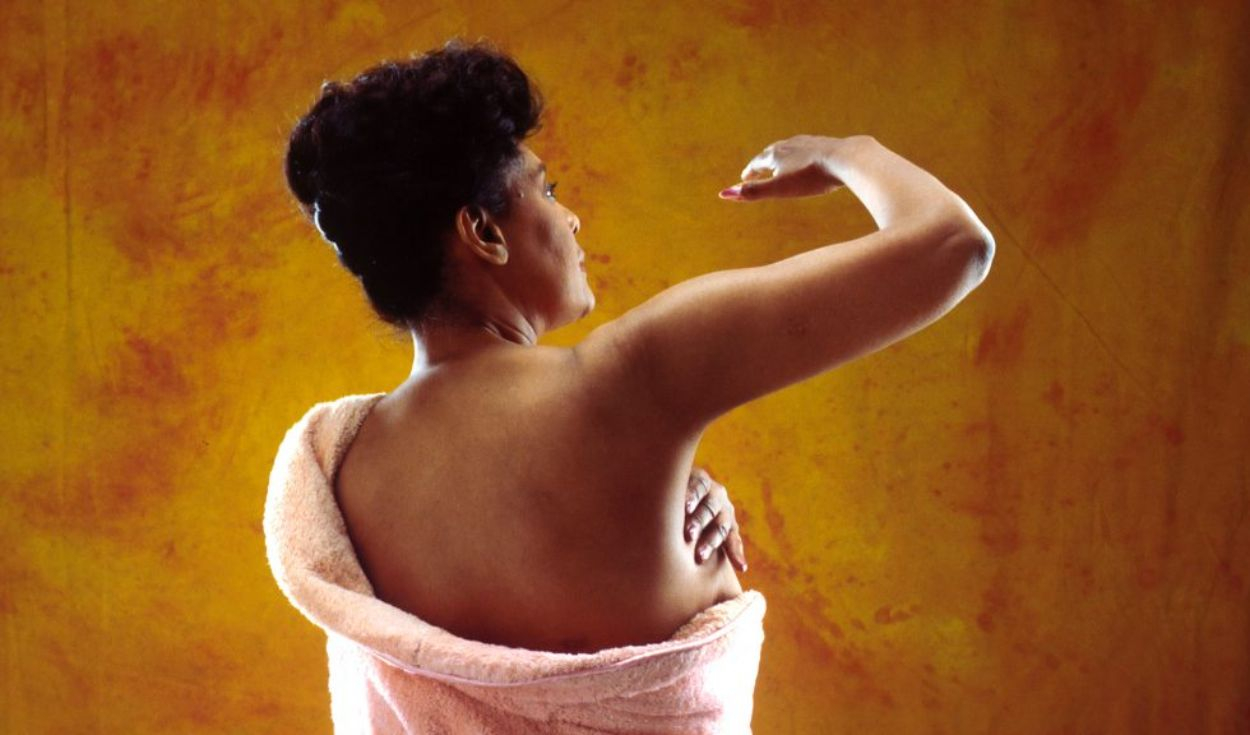 Breast cancer patients in Peru face year-long treatment delays