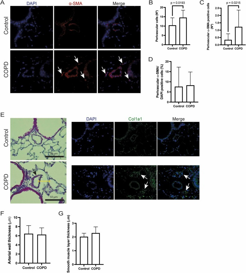 Células perivasculares α-SMA positivas y grosor de la pared arterial en el modelo de EPOC. Foto: Science Direct