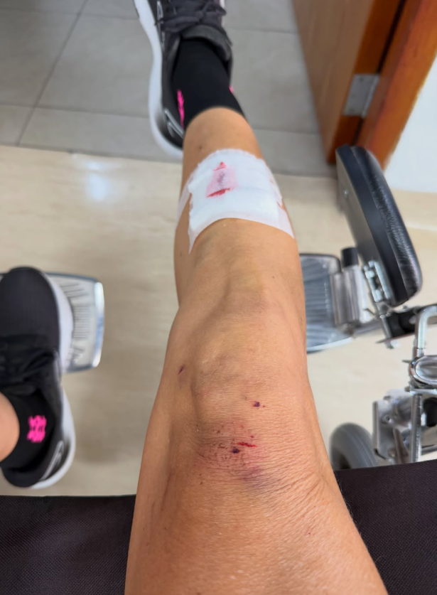 Anna Carina Copello reveló imagen tras su accidente