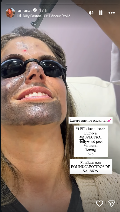 Stephanie Cayo, pareja de Alejandro Sanz, compartió su tratamiento facial no invasivo. Foto: captura Instagram