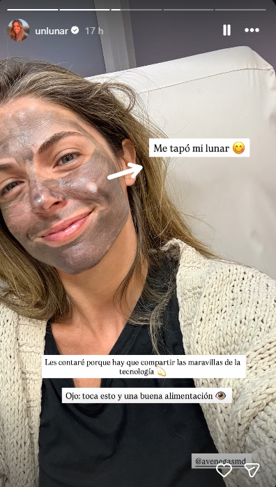 Stephanie Cayo, pareja de Alejandro Sanz, compartió su tratamiento facial no invasivo. Foto: captura Instagram