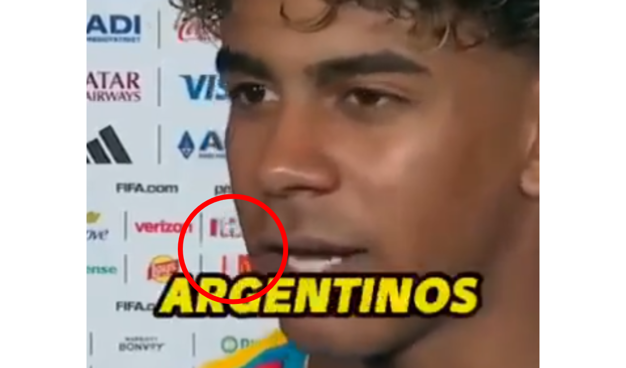 Los logotipos ubicados detrás de la boca se deforman conforme el jugador habla. Foto: Instagram