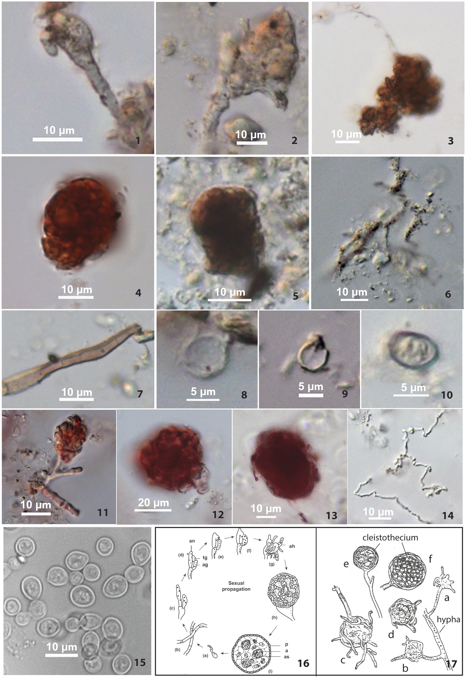 Hongos en cerámica Shangshan frente a Monascus moderno: hallan hifas, cleistotecios y células de levadura en desarrollo. Foto: PNAS