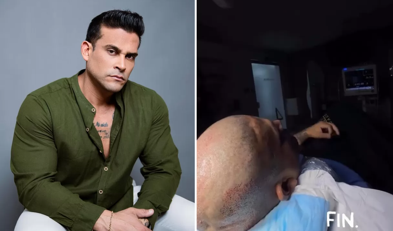 Christian Domínguez impacta al raparse el cabello y desata revuelo con su nueva imagen