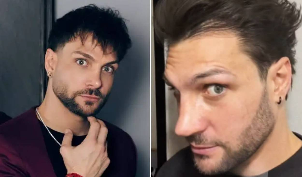 Nicola Porcella sorprende al mostrar su renovada nariz tras someterse a una nueva operación y genera reacciones