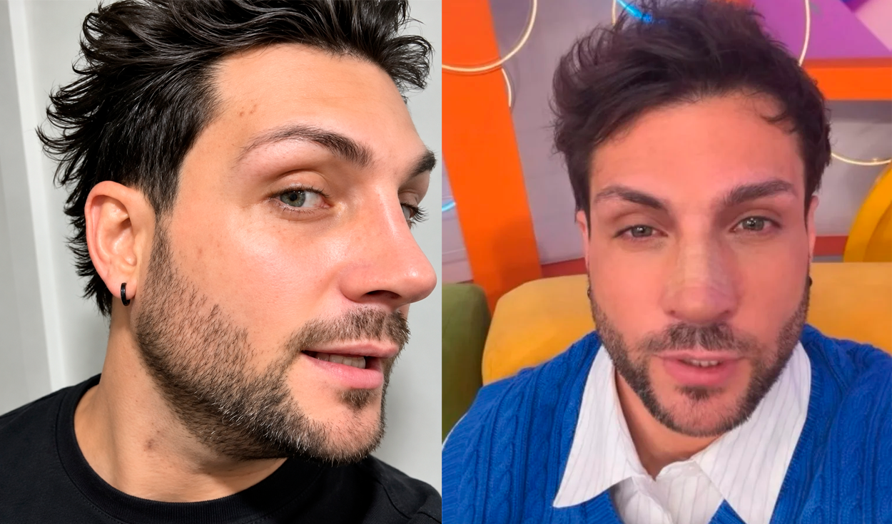 Nicola Porcella rompe su silencio tras su nueva operación de nariz: “Me estaba volviendo loco”