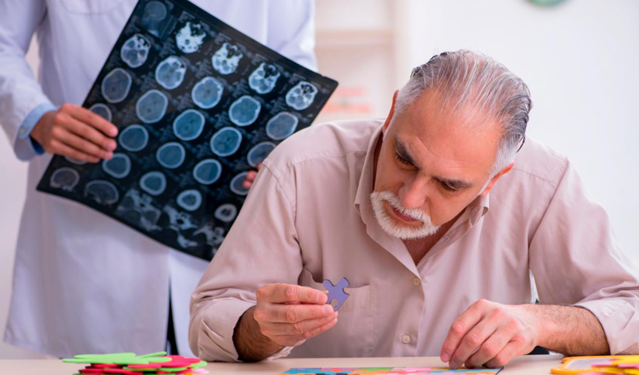 Nuevo hallazgo sobre el Alzheimer: las personas con esta enfermedad presentaban estos síntomas años antes del diagnóstico