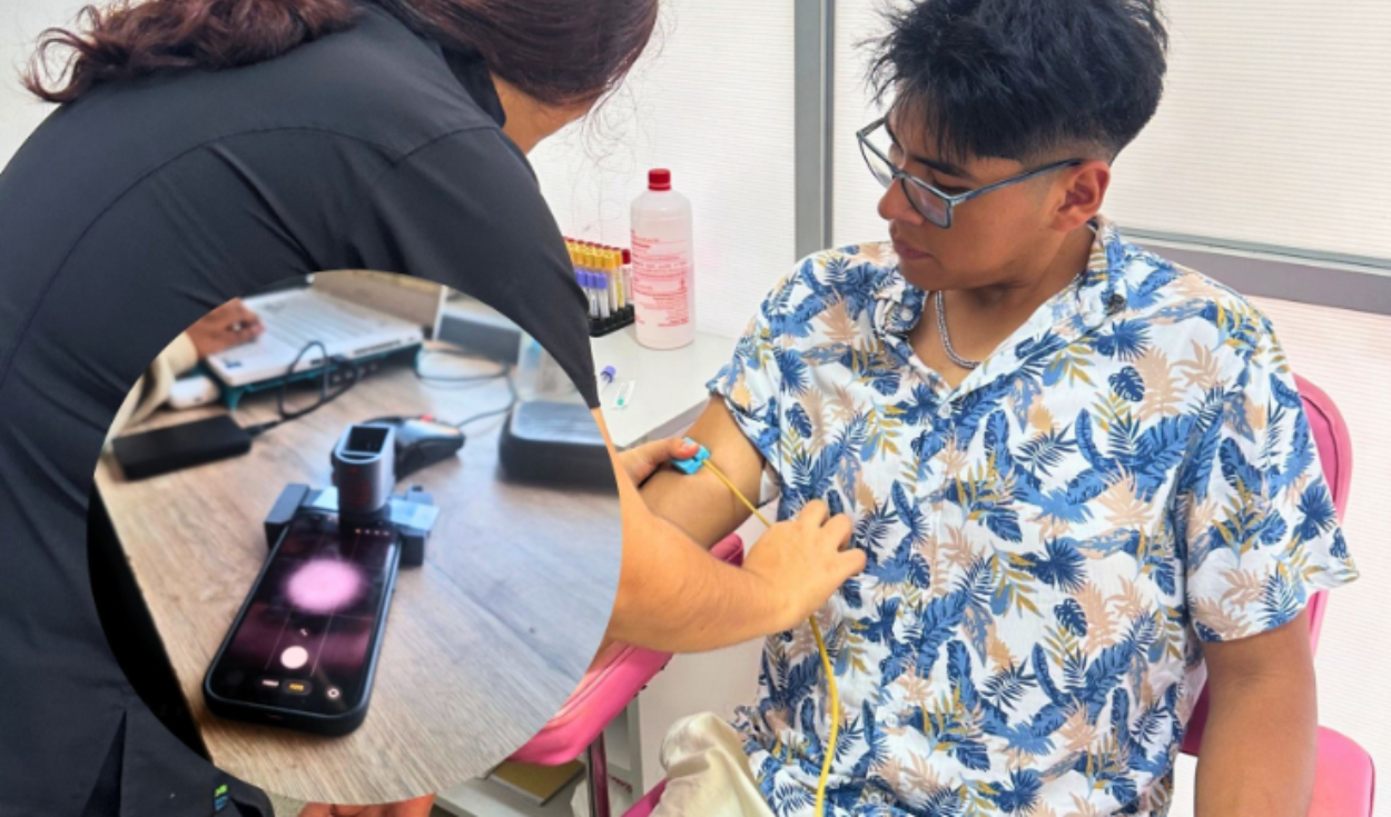 Peruano convierte celular en microscopio para detectar anemia con IA: pruebas arrojan 92% de precisión
