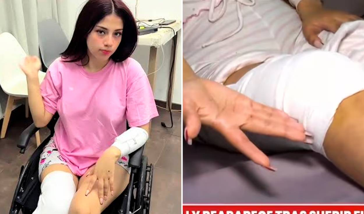 TikToker Zully recibe 40 puntos en la pierna tras sufrir aparatoso accidente y reaparece en silla de ruedas: "Tuve todos esos cortes"